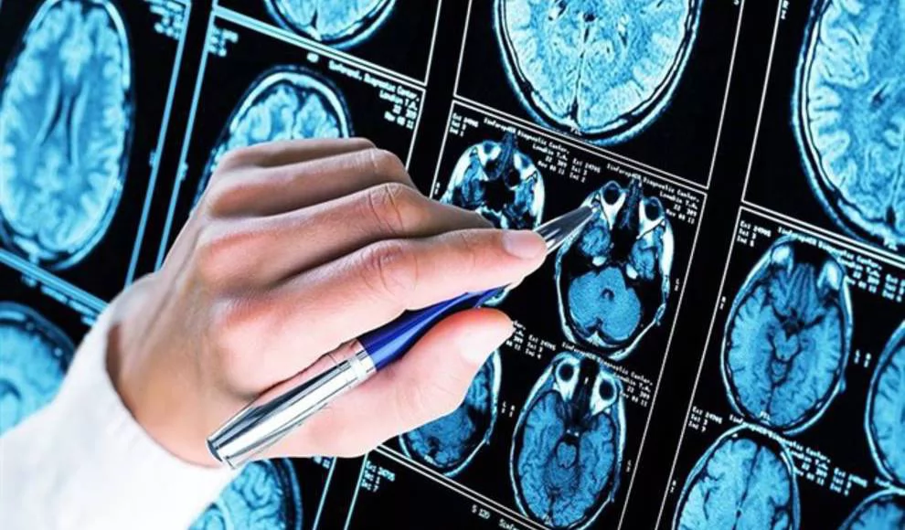 La Usal culmina un proyecto para la investigación sobre la calidad de vida de las personas con enfermedades neurodegenerativas