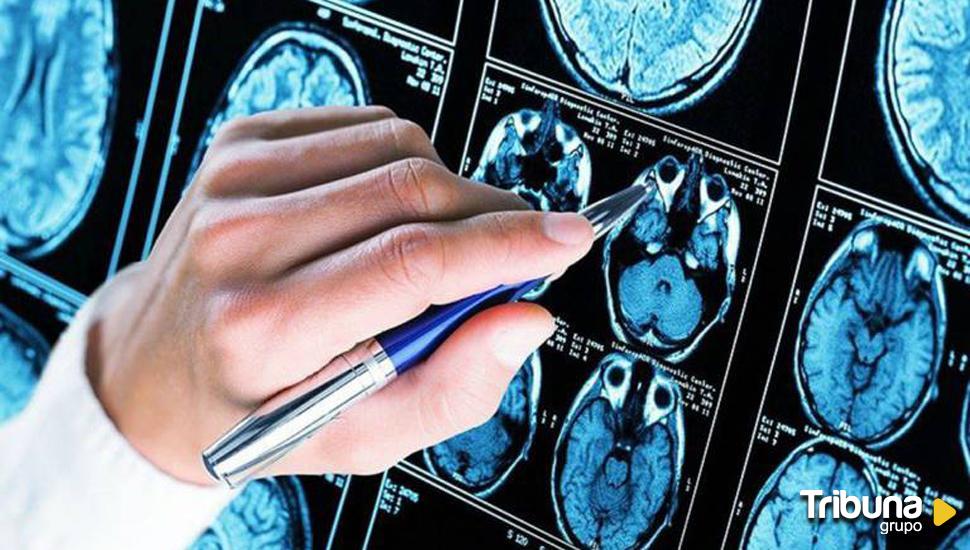 Un fármaco experimental ralentiza la progresión del Alzheimer en fase temprana