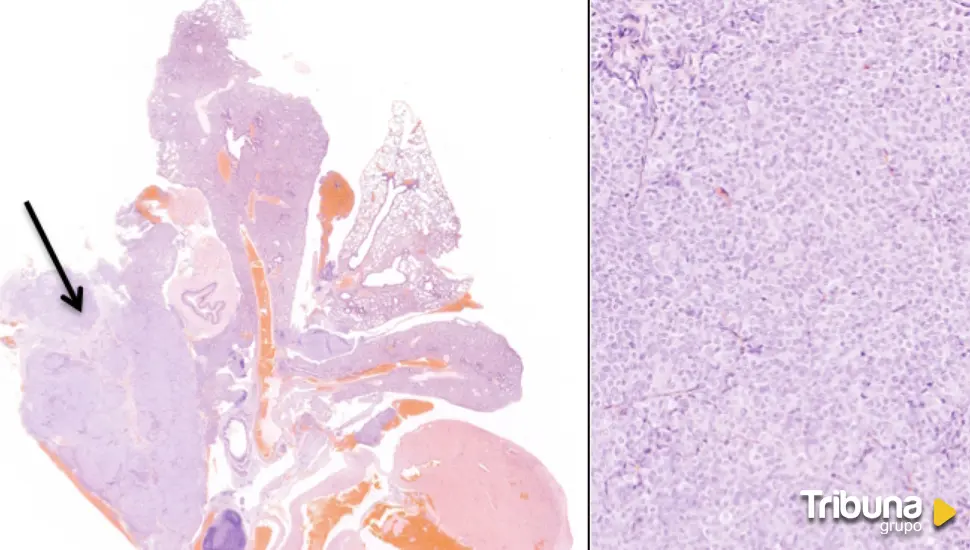 Investigadores de la USAL estudian nuevos abordajes farmacológicos en cáncer de pulmón resistente a tratamiento